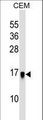 LGALSL / Galectin 5 Antibody - HSPC159 Antibody western blot of CEM cell line lysates (35 ug/lane). The HSPC159 antibody detected the HSPC159 protein (arrow).