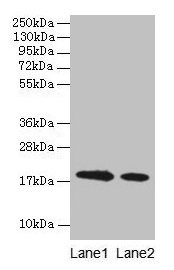 LGB / Beta-Lactoglobulin Antibody - Western blot All lanes: Bovine milk &beta;-Lactoglobulin antibody at 2µg/ml Lane 1: Bovine milk &beta;-Lactoglobulin at 0.1mg/ml Lane 2: Bovine milk &beta;-Lactoglobulin at 10µg/ml Secondary Goat polyclonal to rabbit IgG at 1/15000 dilution Predicted band size: 18 kDa Observed band size: 18 kDa