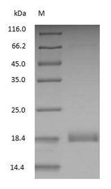 LGB / Beta-Lactoglobulin Protein - (Tris-Glycine gel) Discontinuous SDS-PAGE (reduced) with 5% enrichment gel and 15% separation gel.