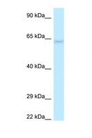 LGI1 Antibody - LGI1 antibody Western blot of HCT15 Cell lysate. Antibody concentration 1 ug/ml.  This image was taken for the unconjugated form of this product. Other forms have not been tested.