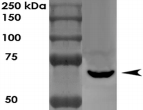 LGI1 Antibody - Detection of LGI1 in rat brain lysate with LGI1 Monoclonal Antibody at 1ug/ml.
