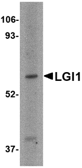 LGI1 Antibody - Western blot of LGI1 in HeLa cell lysate with LGI1 antibody at 2 ug/ml.