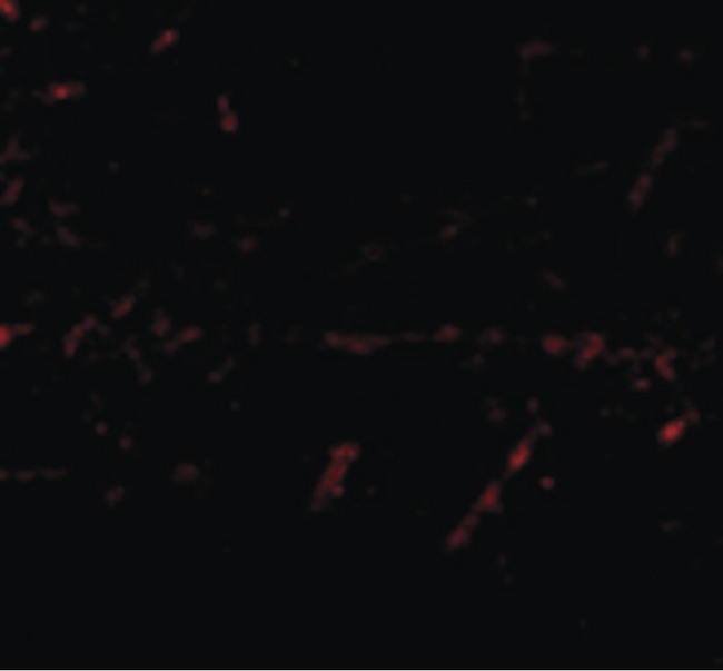 LGI1 Antibody - Immunofluorescence of LGI1 in Human Brain cells with LGI1 antibody at 20 ug/ml.