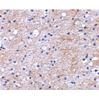 LGI1 Antibody - Immunohistochemical staining of human brain tissue using LGI1 antibody at 2.5 µg/mL.