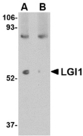 LGI1 Antibody - Western blot of LGI1 in mouse brain tissue lysate with LGI1 antibody at 1 ug/ml in (A) the absence and (B) the presence of blocking peptide.