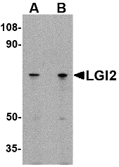 LGI2 Antibody - Western blot of LGI2 in 293 cell lysate with LGI2 antibody at (A) 1 and (B) 2 ug/ml.