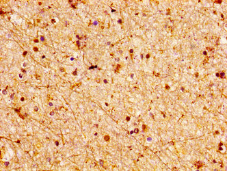 LGI2 Antibody - Immunohistochemistry image at a dilution of 1:100 and staining in paraffin-embedded human brain tissue performed on a Leica BondTM system. After dewaxing and hydration, antigen retrieval was mediated by high pressure in a citrate buffer (pH 6.0) . Section was blocked with 10% normal goat serum 30min at RT. Then primary antibody (1% BSA) was incubated at 4 °C overnight. The primary is detected by a biotinylated secondary antibody and visualized using an HRP conjugated SP system.