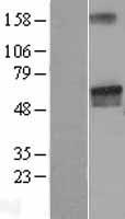 LGI2 Protein - Western validation with an anti-DDK antibody * L: Control HEK293 lysate R: Over-expression lysate