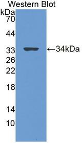 LGI3 Antibody - Western blot of LGI3 antibody.