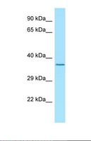 LGI4 Antibody - Western blot of Human Jurkat. LGI4 antibody dilution 1.0 ug/ml.  This image was taken for the unconjugated form of this product. Other forms have not been tested.