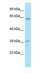 LGI4 Antibody - LGI4 antibody Western Blot of MCF7.  This image was taken for the unconjugated form of this product. Other forms have not been tested.