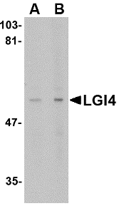LGI4 Antibody - Western blot of LGI4 in rat brain tissue lysate with LGI4 antibody at (A) 1 and (B) 2 ug/ml.