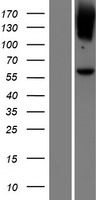 LGI4 Protein - Western validation with an anti-DDK antibody * L: Control HEK293 lysate R: Over-expression lysate