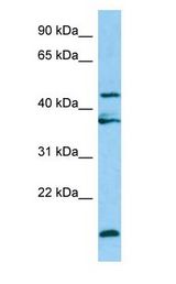 LGMN / Legumain Antibody - LGMN / Legumain antibody Western Blot of HepG2.  This image was taken for the unconjugated form of this product. Other forms have not been tested.