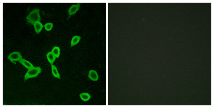 LGR6 Antibody - Immunofluorescence analysis of LOVO cells, using LGR6 Antibody. The picture on the right is blocked with the synthesized peptide.