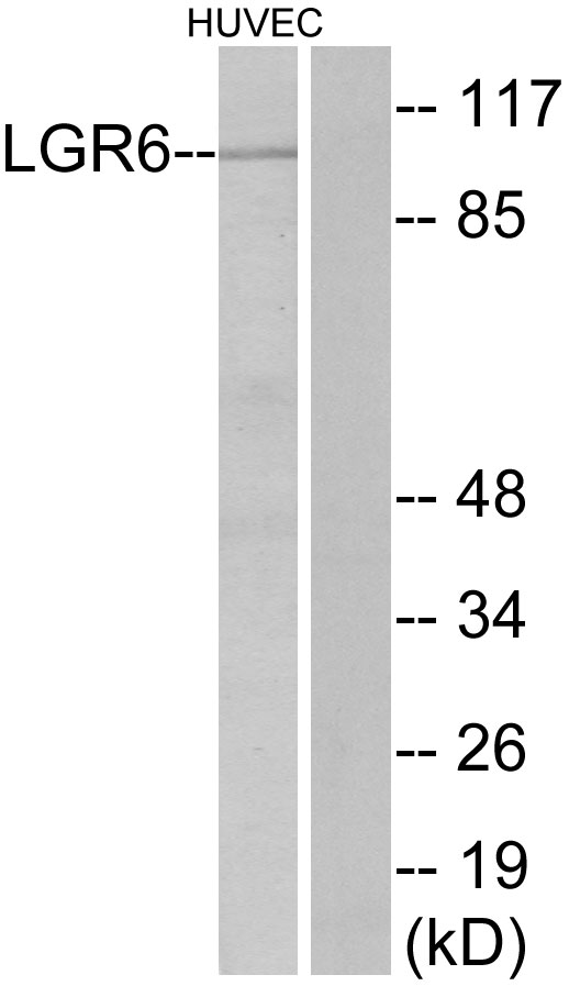 LGR6 Antibody - Western blot analysis of lysates from HUVEC cells, using LGR6 Antibody. The lane on the right is blocked with the synthesized peptide.