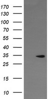 LGR6 Antibody - HEK293T cells lysate (5 ug, left lane) and HEK293T cells lysate expressing human recombinant protein fragment (5 ug, right lane) corresponding to amino acids 25-250 of human LGR6(NP_001017403) were separated by SDS-PAGE and immunoblotted with anti-LGR6.