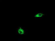 LGR6 Antibody - Anti-LGR6 mouse monoclonal antibody immunofluorescent staining of COS7 cells transiently transfected by pCMV6-ENTRY LGR6.
