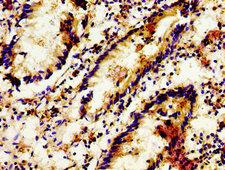LGR6 Antibody - Immunohistochemistry image of paraffin-embedded human appendix tissue at a dilution of 1:100