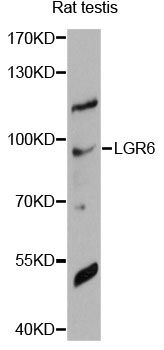 LGR6 Antibody - Western blot analysis of extracts of rat testis, using LGR6 antibody at 1:1000 dilution. The secondary antibody used was an HRP Goat Anti-Rabbit IgG (H+L) at 1:10000 dilution. Lysates were loaded 25ug per lane and 3% nonfat dry milk in TBST was used for blocking. An ECL Kit was used for detection and the exposure time was 90s.