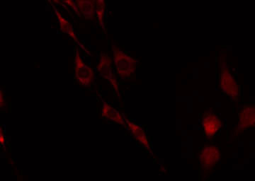 LGR6 Antibody - Staining HuvEc cells by IF/ICC. The samples were fixed with PFA and permeabilized in 0.1% Triton X-100, then blocked in 10% serum for 45 min at 25°C. The primary antibody was diluted at 1:200 and incubated with the sample for 1 hour at 37°C. An Alexa Fluor 594 conjugated goat anti-rabbit IgG (H+L) Ab, diluted at 1/600, was used as the secondary antibody.