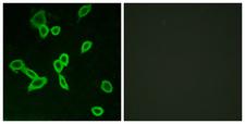 LGR6 Antibody - Peptide - + Immunofluorescence analysis of LOVO cells, using LGR6 antibody.