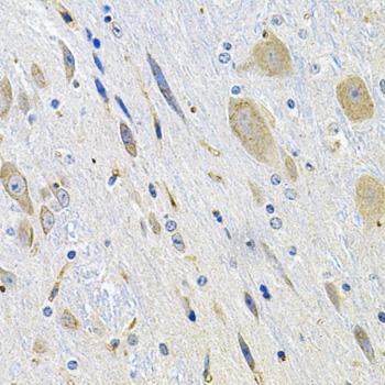 LGR6 Antibody - Immunohistochemistry of paraffin-embedded Mouse brain using LGR6 Polyclonal Antibody at dilution of 1:100 (40x lens).