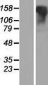 LGR6 Protein - Western validation with an anti-DDK antibody * L: Control HEK293 lysate R: Over-expression lysate