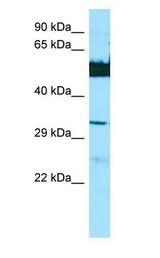 LGSN Antibody - LGSN antibody Western Blot of HepG2.  This image was taken for the unconjugated form of this product. Other forms have not been tested.