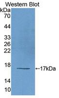 LGTN / EIF2D Antibody - Western blot of LGTN / EIF2D antibody.