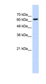 LGTN / EIF2D Antibody - EIF2D / LGTN antibody Western blot of Transfected 293T cell lysate. This image was taken for the unconjugated form of this product. Other forms have not been tested.