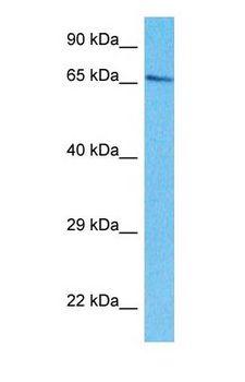 LGTN / EIF2D Antibody - Western blot of EIF2D Antibody with human HepG2 Whole Cell lysate.  This image was taken for the unconjugated form of this product. Other forms have not been tested.