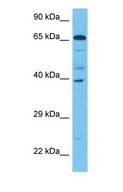 LGTN / EIF2D Antibody - Western blot of EIF2D Antibody with human Fetal Liver lysate.  This image was taken for the unconjugated form of this product. Other forms have not been tested.