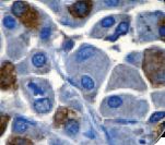 LH / Luteinizing Hormone Antibody - IHC of LH on FFPE Pituitary tissue. This image was taken for the unmodified form of this product. Other forms have not been tested.