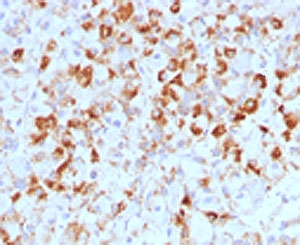 LHB / Luteinizing Hormone Antibody - IHC testing of FFPE human pituitary with LHB antibody (CCGD1). This image was taken for the base form of this product. Alternate forms, such as conjugated, azide-free, or ready-to-use, have not been tested. This image was taken for the unmodified form of this product. Other forms have not been tested.