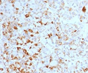 LHB / Luteinizing Hormone Antibody - Formalin-fixed, paraffin-embedded human pituitary stained with Luteinizing Hormone beta antibody (LHb/1214). This image was taken for the base form of this product. Alternate forms, such as conjugated, azide-free, or ready-to-use, have not been tested. This image was taken for the unmodified form of this product. Other forms have not been tested.