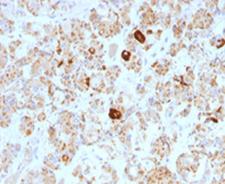 LHB / Luteinizing Hormone Antibody - Formalin-fixed, paraffin-embedded human pituitary stained with Luteinizing Hormone beta antibody (SPM103). This image was taken for the base form of this product. Alternate forms, such as conjugated, azide-free, or ready-to-use, have not been tested. This image was taken for the unmodified form of this product. Other forms have not been tested.