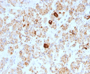 LHB / Luteinizing Hormone Antibody - Formalin-fixed, paraffin-embedded human pituitary stained with Luteinizing Hormone beta antibody (SPM103). This image was taken for the base form of this product. Alternate forms, such as conjugated, azide-free, or ready-to-use, have not been tested.