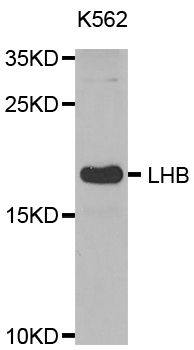 LHB / Luteinizing Hormone Antibody - Western blot analysis of extracts of K562 cell line, using LHB antibody.