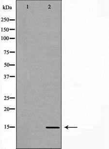 LHB / Luteinizing Hormone Antibody - Western blot analysis of extracts of mouse pituitary using LHB antibody. The lane on the left is treated with the antigen-specific peptide.