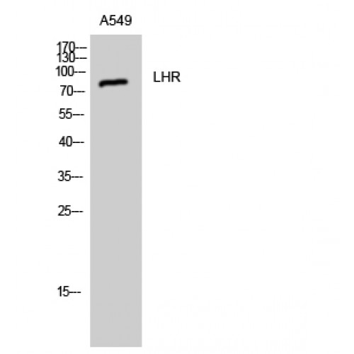 LHCGR / LHR / LH Receptor Antibody - Western blot of LHR antibody