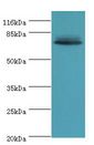 LHCGR / LHR / LH Receptor Antibody - Western blot. All lanes: Lhcgr antibody at 2 ug/ml+rat adrenal gland tissue. Secondary antibody: goat polyclonal to rabbit at 1:10000 dilution. Predicted band size: 78 kDa. Observed band size: 78 kDa.