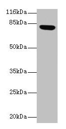 LHCGR / LHR / LH Receptor Antibody - Western blot All lanes: Lhcgr antibody at 2µg/ml + Rat adrenal gland tissue Secondary Goat polyclonal to rabbit IgG at 1/10000 dilution Predicted band size: 79, 35, 38, 73, 28, 33, 21, 72, 31, 34, 41 kDa Observed band size: 79 kDa