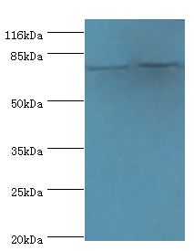 LHCGR / LHR / LH Receptor Antibody - Western blot. All lanes: LHCGR antibody at 2 ug/ml. Lane 1: mouse brain tissue Lane 2: mouse kidney tissue. Secondary antibody: goat polyclonal to rabbit at 1:10000 dilution. Predicted band size: 79 kDa. Observed band size: 79 kDa.