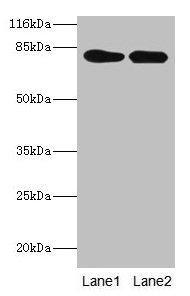 LHCGR / LHR / LH Receptor Antibody - Western blot All lanes: LHCGR antibody at 2µg/ml Lane 1: Mouse brain tissue Lane 2: Mouse kidney tissue Secondary Goat polyclonal to rabbit IgG at 1/10000 dilution Predicted band size: 79, 72 kDa Observed band size: 79 kDa
