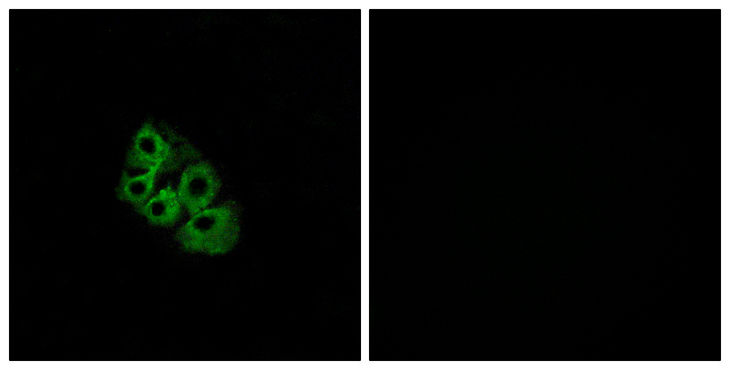 LHCGR / LHR / LH Receptor Antibody - Immunofluorescence analysis of A549 cells, using LSHR Antibody. The picture on the right is blocked with the synthesized peptide.