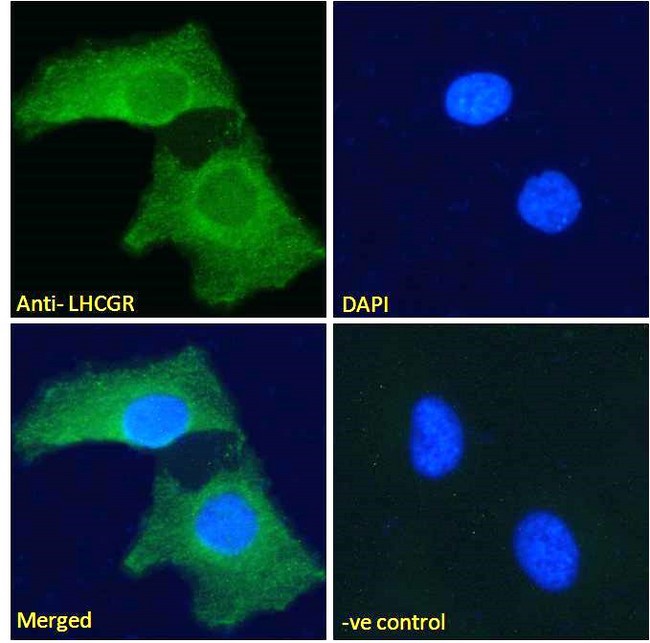 LHCGR / LHR / LH Receptor Antibody - Goat Anti-LHCGR Antibody Immunofluorescence analysis of paraformaldehyde fixed HeLa cells, permeabilized with 0.15% Triton. Primary incubation 1hr (10ug/ml) followed by Alexa Fluor 488 secondary antibody (2ug/ml), showing plasma membrane staining. The nuclear stain is DAPI (blue). Negative control: Unimmunized goat IgG (10ug/ml) followed by Alexa Fluor 488 secondary antibody (2ug/ml).