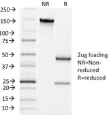 LHCGR / LHR / LH Receptor Antibody - SDS-PAGE Analysis of Purified, BSA-Free hCG Receptor Antibody (clone LHCGR/1415). Confirmation of Integrity and Purity of the Antibody.