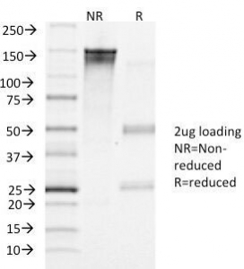 LHCGR / LHR / LH Receptor Antibody - SDS-PAGE Analysis of Purified, BSA-Free LHR Antibody (clone LHCGR/1417). Confirmation of Integrity and Purity of the Antibody.