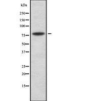 LHCGR / LHR / LH Receptor Antibody - Western blot analysis of LHR using K562 whole cells lysates